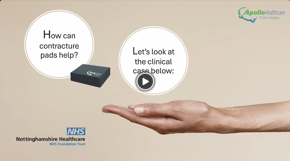 🚨 Did you know that nearly 20% of people over 65 in the UK are living with contractures? 🤯